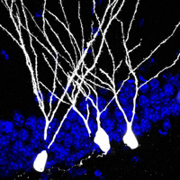 retrovirus cells