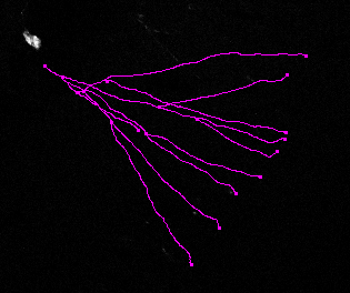 Tracing Neurons Using Fiji Imagej